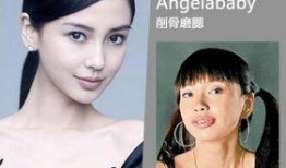 成都整容爆料案件最新,揭開(kāi)醫(yī)美行業(yè)潛規(guī)則與維權(quán)困境