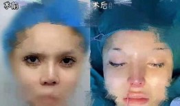 爆料整容視頻,視頻爆料引發熱議